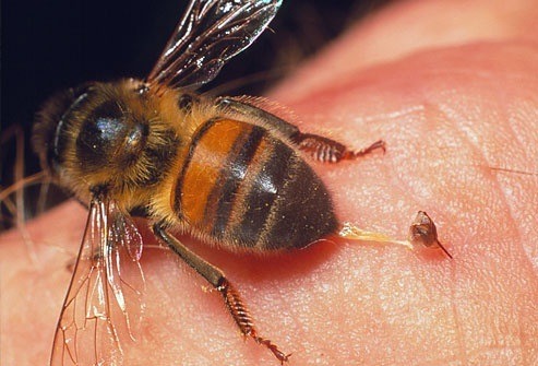honey bee venom